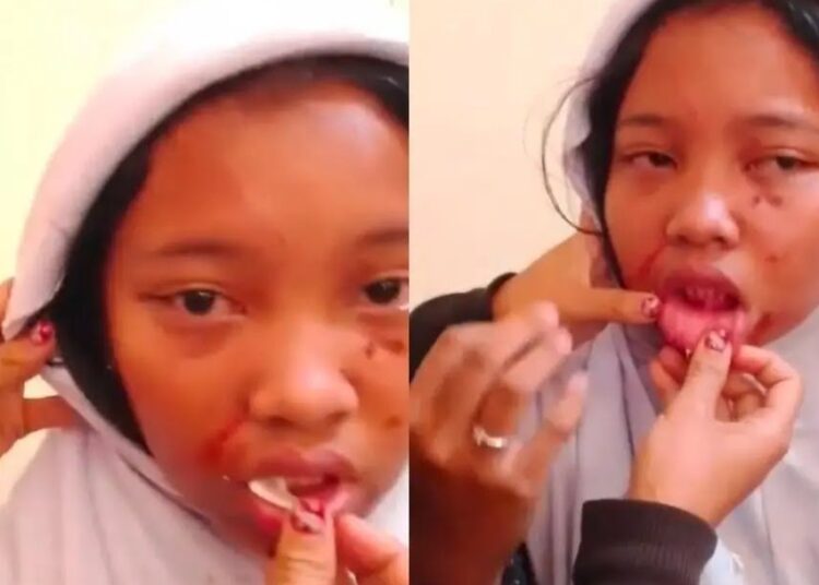 Disdik Palembang Tanggapi Kasus Dugaan Perundungan di SMP Negeri 31